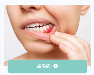 歯周病